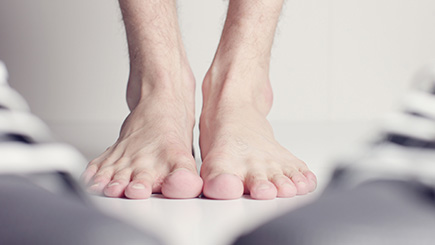 Bunions Image